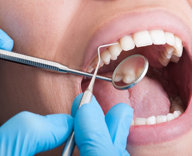 Closeup of someone’s teeth being examined with dental instruments