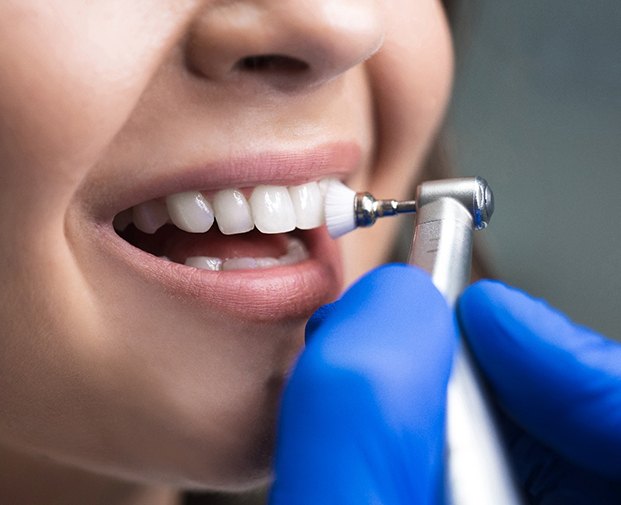 Nose-to-chin closeup of woman’s teeth being polished